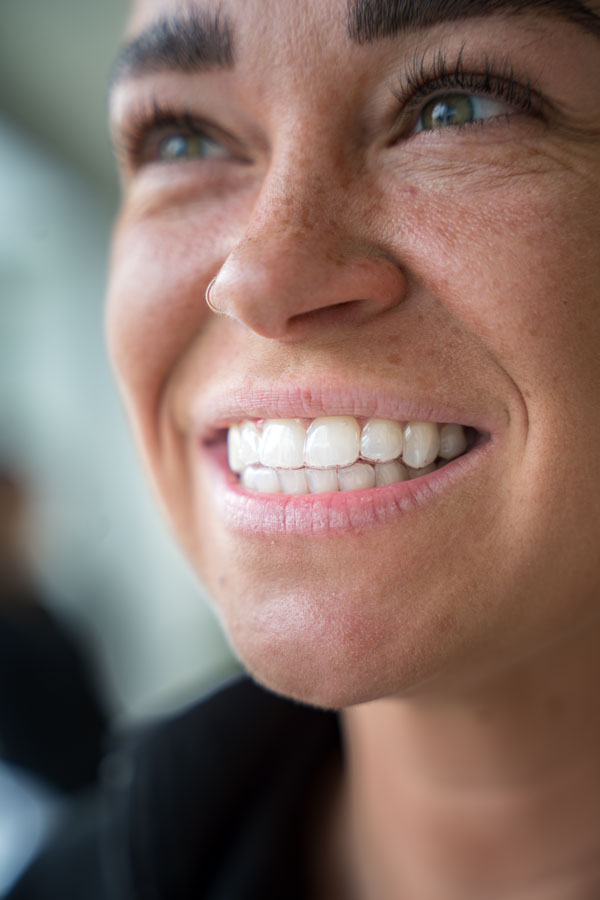 Patientin mit transparenten Alignern zur Zahnkorrektur im MVZ Rage-Holm Bocholt
