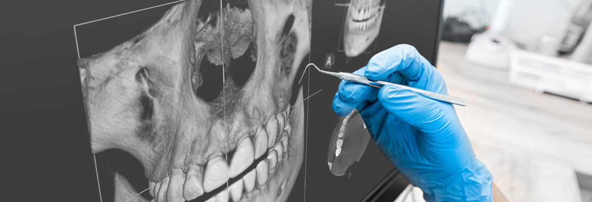 DIGITALE VOLUMENTOMOGRAPHIE