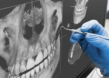 DIGITALE VOLUMENTOMOGRAPHIE