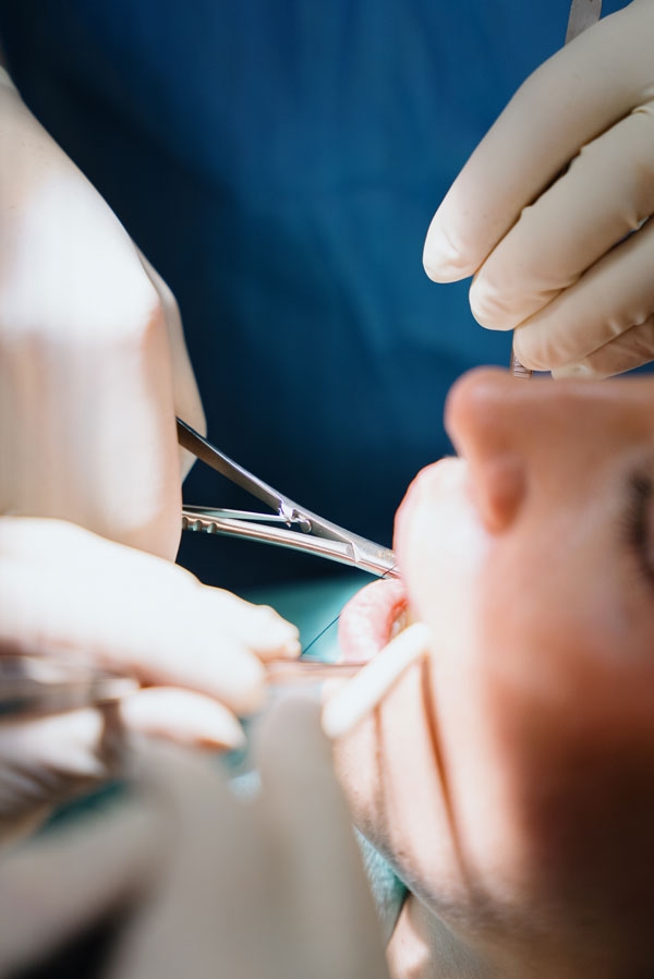 Oralchirurgischer Eingriff beim Zahnarzt im MVZ Rage-Holm Bocholt