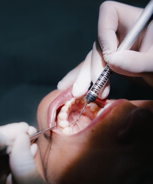 Parodontologie Behandlung beim Zahnarzt im MVZ Rage-Holm Bocholt