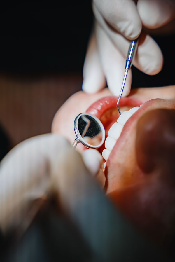 Zahnärztliche Untersuchung der Zähne mit Spiegel und Sonde im MVZ Rage-Holm Bocholt